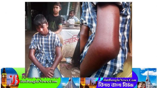 বাহুবলে রিক্সা চালককে পিঠিয়ে হাত ভেঙ্গে দিল পুলিশ!