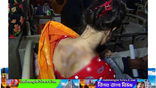 মৌলভীবাজারে গৃহবধূর ওপর স্বামীর বর্বরতা