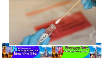 যুক্তরাজ্যে ৪৩ বার করোনা পজিটিভ রোগী এবার করোনামুক্ত