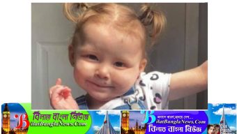 যুক্তরাজ্যে রিমোটের ব্যাটারি গিলে খাদ্যনালীতে ছিদ্র, ২ বছরের শিশুর মর্মান্তিক মৃত্যু