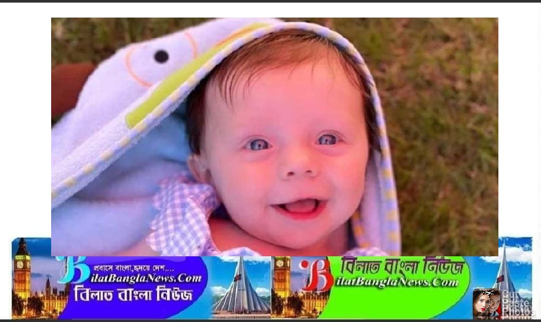 ইংল্যান্ডে ৫ মাসের একটি শিশু ‘পাথর’ হয়ে যাচ্ছে