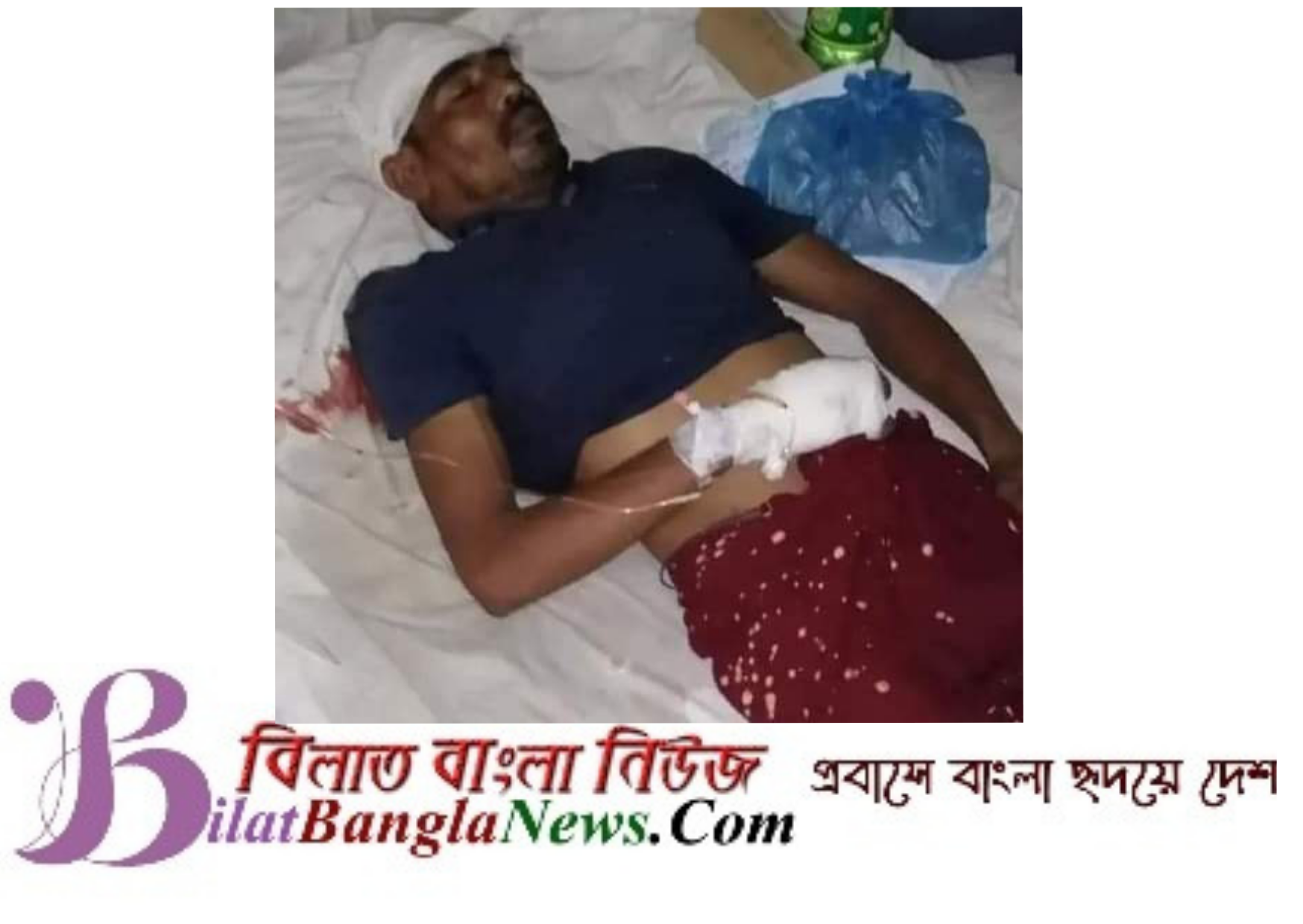 ছাতকে খুঁটিতে কাজ করার সময় বৈদ্যুতিক শর্টে শ্রমিক আহত