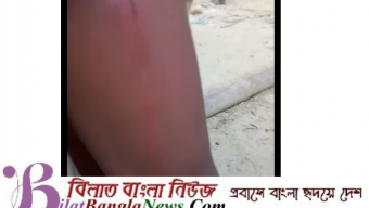 ছাতকে শিক্ষকের লাঠি পেঠায় শিক্ষার্থী আহত