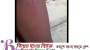 ছাতকে শিক্ষকের লাঠি পেঠায় শিক্ষার্থী আহত