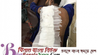 ছাতকে যুবকের পিট ক্ষত-বিক্ষত: হামলাকারী যুবককে আটকের পর কারাগারে প্রেরণ