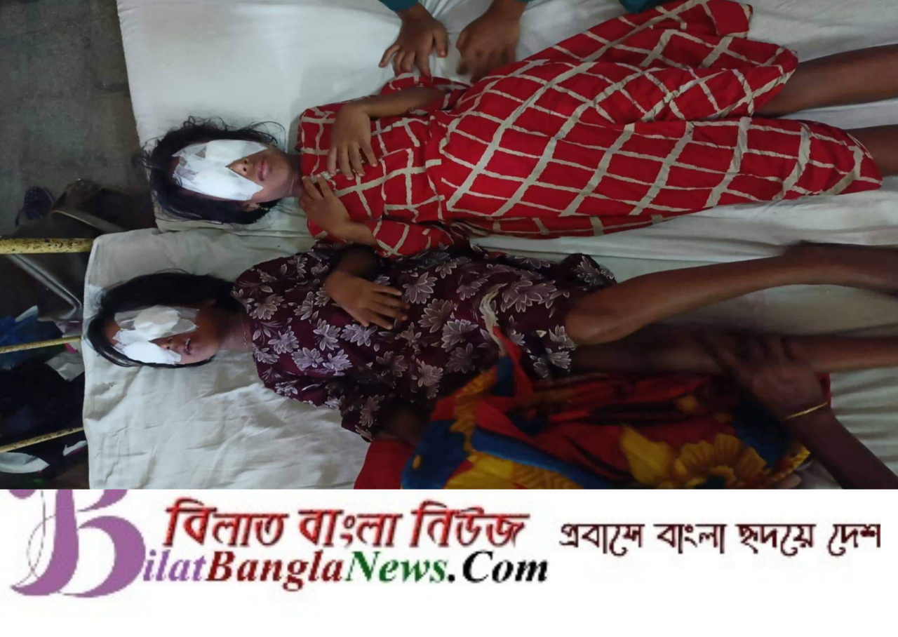 ইউটিউব দেখে খেলার ছলে বোমা তৈরি করতে গিয়ে বিস্ফোরণে দুই শিশু আহত