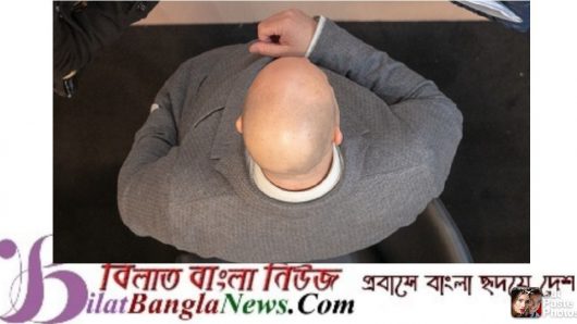 যুক্তরাজ্যে টাক নিয়ে রসিকতা যৌন হয়রানির সামিল