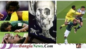মুখের হাড় ও চোয়াল ভেঙে গেছে সৌদি ফুটবলারের