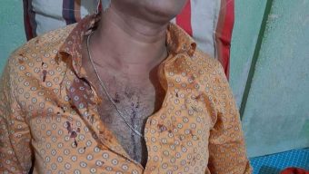 কলেজ শিক্ষকের উপর সন্ত্রাসীদের হামলায় রক্তাক্ত জখম, বসত ঘর ভাংচুর