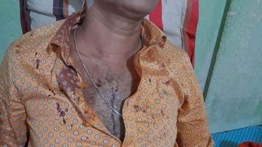 কলেজ শিক্ষকের উপর সন্ত্রাসীদের হামলায় রক্তাক্ত জখম, বসত ঘর ভাংচুর