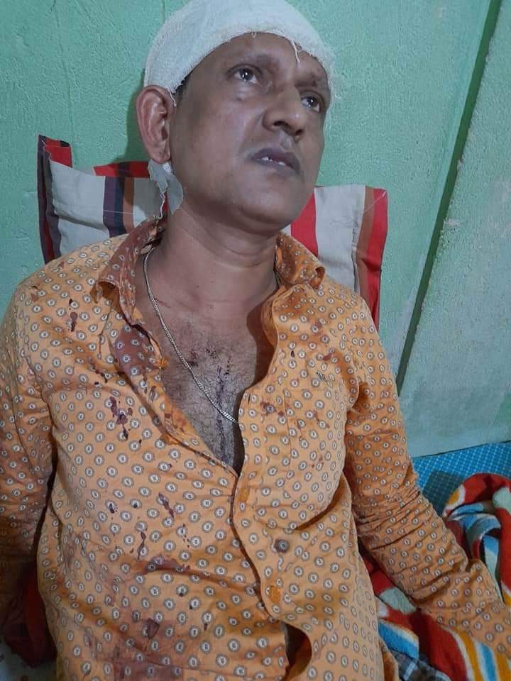 কলেজ শিক্ষকের উপর সন্ত্রাসীদের হামলায় রক্তাক্ত জখম, বসত ঘর ভাংচুর