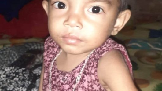 শিশু হামিমা সবার সহযোগীতায় বাঁচতে চায়