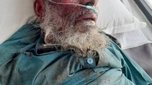 ছাতকে সড়ক দুর্ঘটনায় সামছু নামের এক বৃদ্ধের মৃত্যু