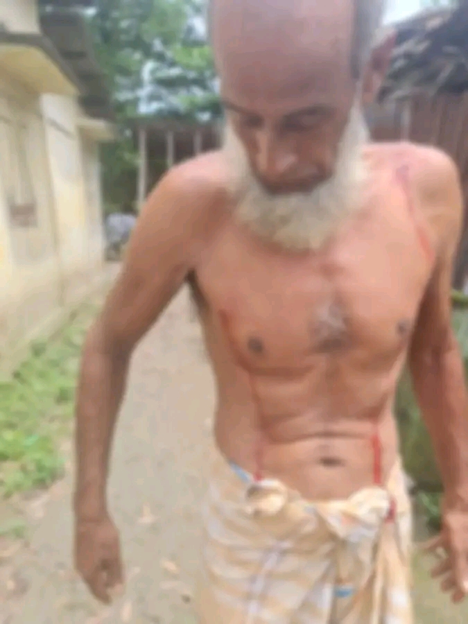জগন্নাথপুরে নামাজে যাওয়ার পথে গুলিবিদ্ধ ২ জন, এলাকায় আতঙ্ক